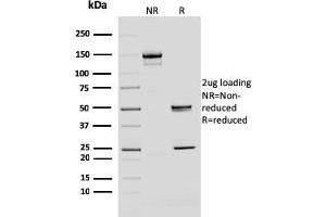 Image no. 1 for anti-BMI1 Polycomb Ring Finger Oncogene (BMI1) (AA 142-326) antibody (ABIN6940581)