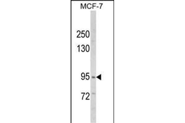 VPS53 Antikörper  (N-Term)