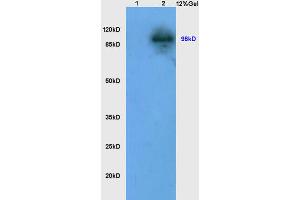 Image no. 5 for anti-Lon Peptidase 1, Mitochondrial (LONP1) (AA 361-460) antibody (ABIN705806)