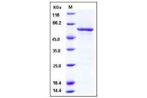 Image no. 1 for SET and MYND Domain Containing 3 (SMYD3) (AA 35-369) protein (GST tag) (ABIN2004107)