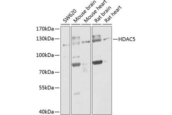 HDAC5 Antikörper  (AA 550-650)