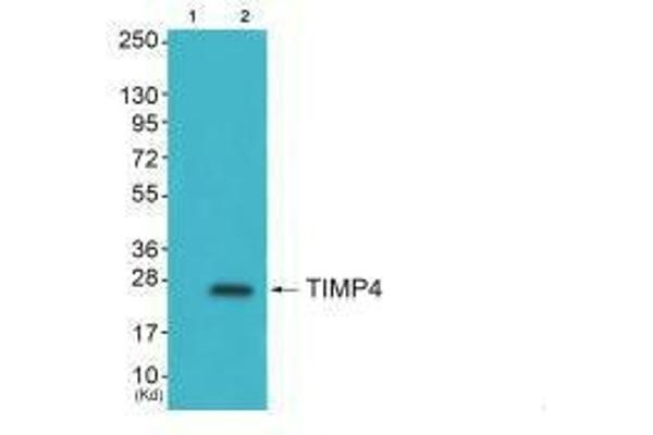 TIMP4 antibody  (C-Term)