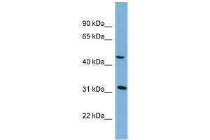 Image no. 2 for anti-serpin Peptidase Inhibitor, Clade I (Pancpin), Member 2 (SERPINI2) (Middle Region) antibody (ABIN2786839)