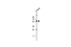 Image no. 3 for anti-Solute Carrier Family 11 (Proton-Coupled Divalent Metal Ion Transporters), Member 1 (SLC11A1) (AA 250-276) antibody (ABIN652453)