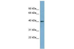 Image no. 1 for anti-Retinitis Pigmentosa 2 (X-Linked Recessive) (RP2) (Middle Region) antibody (ABIN2786864)