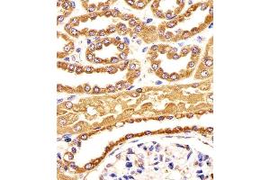 Image no. 2 for anti-B-Cell Receptor-Associated Protein 31 (BCAP31) (AA 120-147) antibody (ABIN1881103)