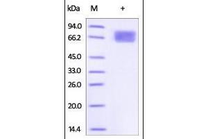Image no. 2 for Interleukin 2 Receptor, alpha (IL2RA) (AA 22-213) (Active) protein (Fc Tag) (ABIN2181381)