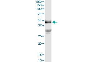 Image no. 1 for anti-Platelet Derived Growth Factor D (PDGFD) (AA 1-364) antibody (ABIN529260)