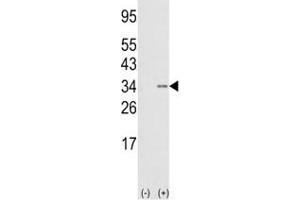 Image no. 4 for anti-SNAIL (SNAI1) (AA 9-39) antibody (ABIN3032657)