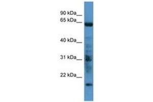 Image no. 1 for anti-G Protein-Coupled Receptor Kinase 7 (GRK7) (C-Term) antibody (ABIN6746684)