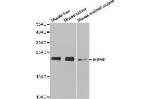 Image no. 1 for anti-Microseminoprotein, beta (MSMB) antibody (ABIN3015771)