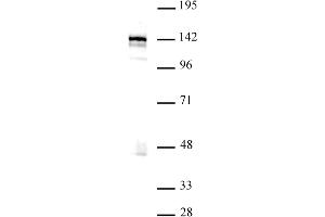 Image no. 1 for anti-Bromodomain Containing 8 (BRD8) (N-Term) antibody (ABIN6971466)