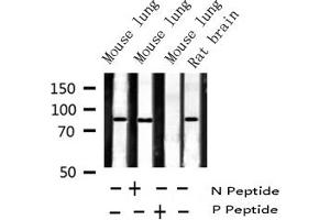 Image no. 3 for anti-Inhibitor of kappa Light Polypeptide Gene Enhancer in B-Cells, Kinase beta (IKBKB) (pTyr199) antibody (ABIN6256667)