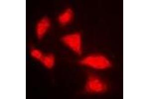 Image no. 1 for anti-Apolipoprotein B mRNA Editing Enzyme, Catalytic Polypeptide-Like 3G (APOBEC3G) antibody (ABIN2966431)