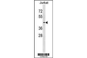 Image no. 1 for anti-Potassium Voltage-Gated Channel, Shaker-Related Subfamily, beta Member 3 (KCNAB3) (AA 176-204) antibody (ABIN1537960)