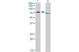 Image no. 3 for anti-Ewing Sarcoma Breakpoint Region 1 (EWSR1) (AA 358-453) antibody (ABIN560815)