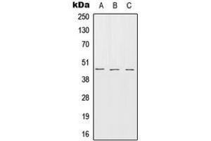 Image no. 1 for anti-serpin Peptidase Inhibitor, Clade B (Ovalbumin), Member 7 (SERPINB7) (Center) antibody (ABIN2707029)