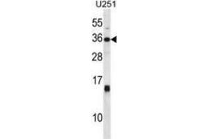 Image no. 1 for anti-Stanniocalcin 1 (STC1) (AA 192-221), (C-Term) antibody (ABIN954968)