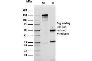 Image no. 1 for anti-LIM Domain Only 2 (Rhombotin-Like 1) (LMO2) (AA 23-140) antibody (ABIN6939967)