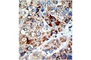 Image no. 2 for anti-Ubiquitin Specific Peptidase 21 (USP21) (N-Term) antibody (ABIN356603)