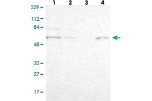 Image no. 1 for anti-Zinc Finger Protein 550 (ZNF550) antibody (ABIN5591391)