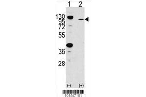 Image no. 1 for anti-Fibroblast Growth Factor Receptor 2 (FGFR2) (AA 22-51), (N-Term) antibody (ABIN391965)