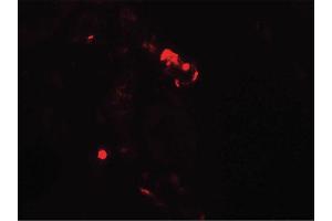 Image no. 1 for anti-KIAA0226 (KIAA0226) (N-Term) antibody (ABIN6657080)