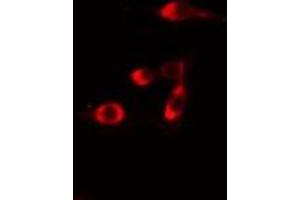 Image no. 2 for anti-DNA Repair Protein RAD51 Homolog 3 (RAD51C) antibody (ABIN6259171)