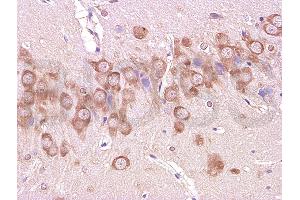 Formalin-fixed and paraffin embedded: rat brain tissue labeled with Anti-beta-Amyloid(1-42) Polyclonal Antibody (ABIN725015), Unconjugated 1:200 followed by conjugation to the secondary antibody and DAB staining