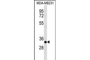 CNS2 Antibody (Center) 19354c western blot analysis in MDA-M cell line lysates (35 μg/lane).