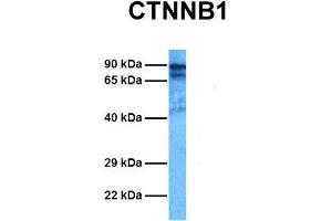 Image no. 6 for anti-Catenin (Cadherin-Associated Protein), beta 1, 88kDa (CTNNB1) (C-Term) antibody (ABIN2792303)