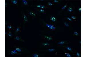 Image no. 4 for anti-Pescadillo Ribosomal Biogenesis Factor 1 (PES1) (AA 1-588) antibody (ABIN525209)