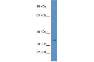 Image no. 2 for anti-Uracil-DNA Glycosylase (UNG) (C-Term) antibody (ABIN2788718)