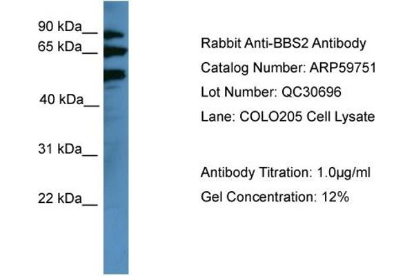 BBS2 antibody  (Middle Region)