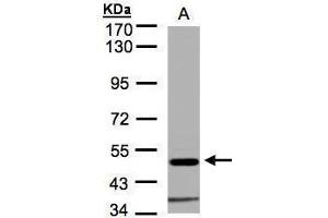 Image no. 1 for anti-Glycine Receptor, alpha 1 (GLRA1) (Center) antibody (ABIN2856259)