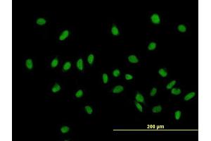 Image no. 2 for anti-Zinc Fingers and Homeoboxes 1 (ZHX1) (AA 1-873) antibody (ABIN524669)