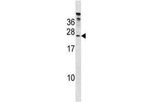Image no. 2 for anti-HIV-1 Tat Specific Factor 1 (HTATSF1) (AA 152-179) antibody (ABIN3028716)