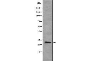 Image no. 1 for anti-COP9 Signalosome Subunit 8 (COPS8) (Internal Region) antibody (ABIN6260973)