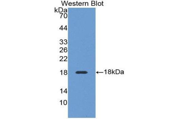 anti-Desert Hedgehog (DHH) (AA 43-190) antibody