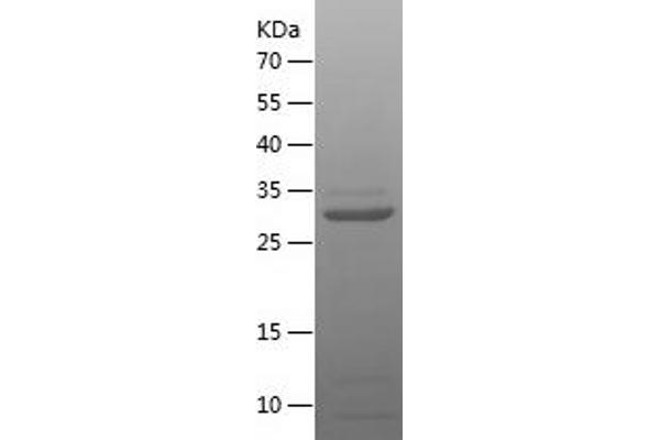 HIF1A Protein (AA 575-825) (His tag)