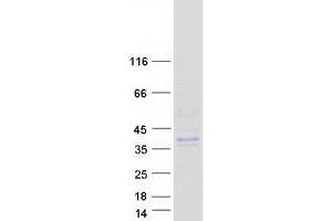 Image no. 1 for Prostate Specific Antigen (PSA) (Transcript Variant 1) protein (Myc-DYKDDDDK Tag) (ABIN2723967)