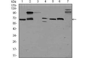 Figure 6: Western blot analysis using GPC3 mouse mAb against HepG2 (1), HEK293 (2), Jurkat (3), SK-N-SH (4), PC-12 (5), F9 (6) and Mouse liver (7) cell lysate.