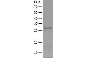 PLEKHA8 Protein (AA 122-400) (His tag)