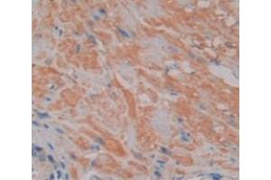 Image no. 2 for anti-Nuclear Factor of Activated T-Cells, Cytoplasmic, Calcineurin-Dependent 2 (NFAT1) (AA 392-574) antibody (ABIN1869443)