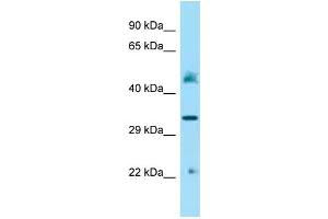 Image no. 1 for anti-Iduronidase, alpha-L- (IDUA) (Middle Region) antibody (ABIN2789574)