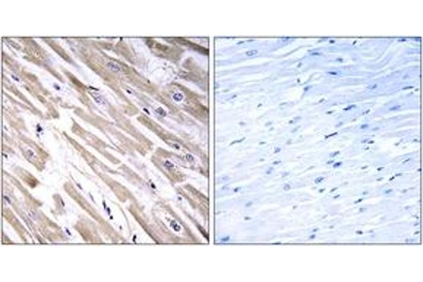 anti-Fibroblast Growth Factor 18 (FGF18) (AA 151-200) antibody