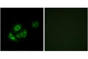 Image no. 3 for anti-Mitochondrial Ribosomal Protein L11 (MRPL11) (AA 21-70) antibody (ABIN1534516)