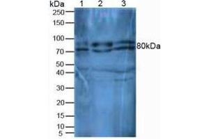 Image no. 2 for Dipeptidyl-Peptidase 4 (DPP4) ELISA Kit (ABIN6574232)