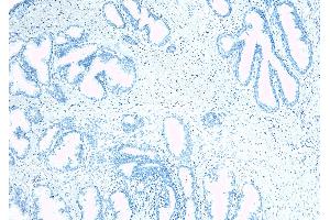 Image no. 4 for anti-Kallikrein 2 (KLK2) (Internal Region) antibody (ABIN190842)