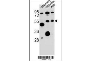 Image no. 1 for anti-SPARC Related Modular Calcium Binding 1 (SMOC1) (AA 284-313), (C-Term) antibody (ABIN657596)